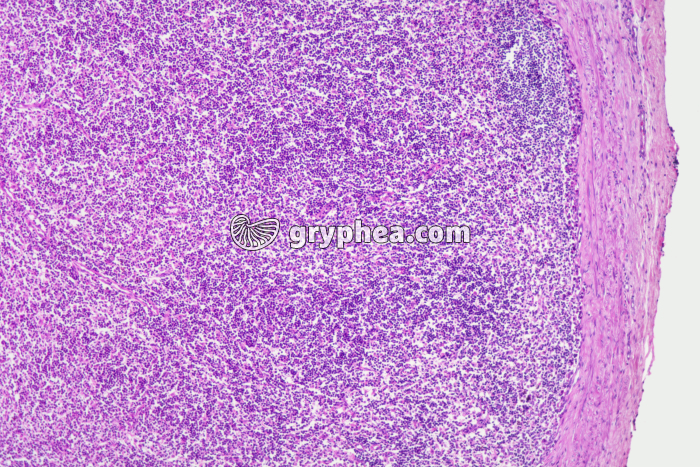 Ganglion lymphatique x25 - gryphea.org